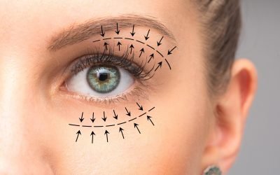 alt-ust-goz-kapagi-estetigi-2021-06-07_13-32-34-08696592214855594 alt-ust-goz-kapagi-estetigi-2021-06-07_13-32-34-08696592214855594