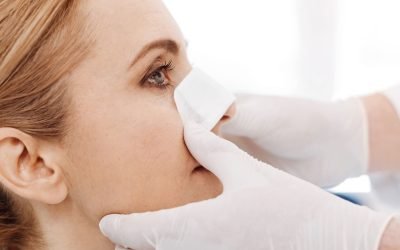 burun-estetigi-2019-09-20_12-14-20-027734785782148097 burun-estetigi-2019-09-20_12-14-20-027734785782148097