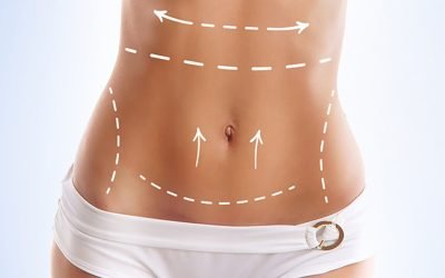 karin-germe-ameliyati-2021-06-07_13-27-07-022048490102150953 karin-germe-ameliyati-2021-06-07_13-27-07-022048490102150953